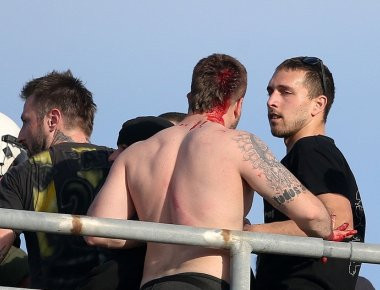 Τελικός Κυπέλλου: Όλες οι συμπλοκές οπαδών- Αστυνομίας (φωτό)